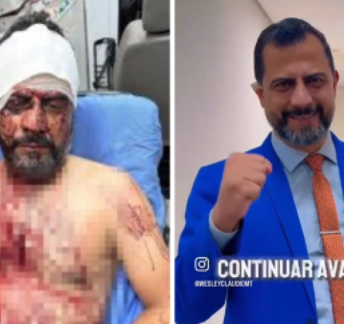 Vereador volta à Câmara após agressão e orelha cortada durante assalto