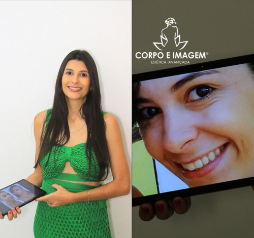 Esteticista Juciely Trevisan afirma: cuidado com a pele desde cedo evita envelhecimento precoce