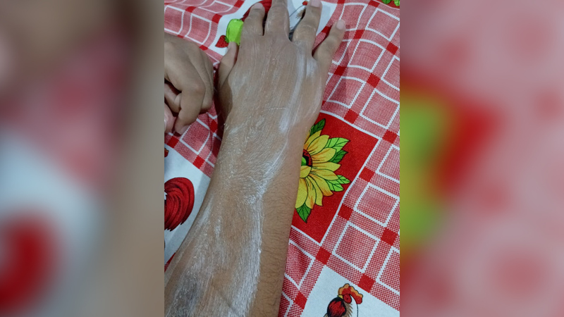Crianças são atacadas por marimbondos em frente à Unifama em Guarantã do Norte