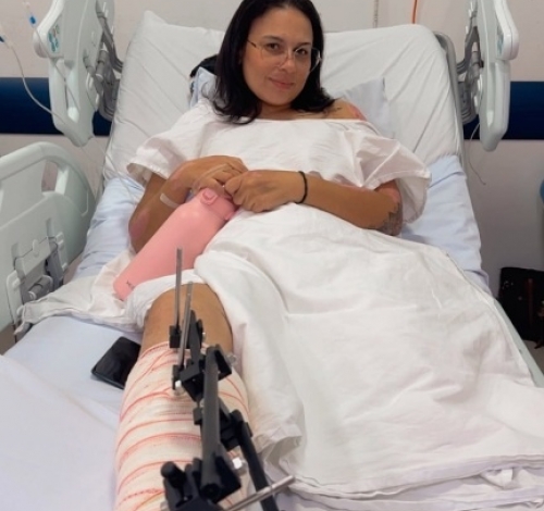 Motociclista que perdeu perna em acidente morre após quase dois meses internada