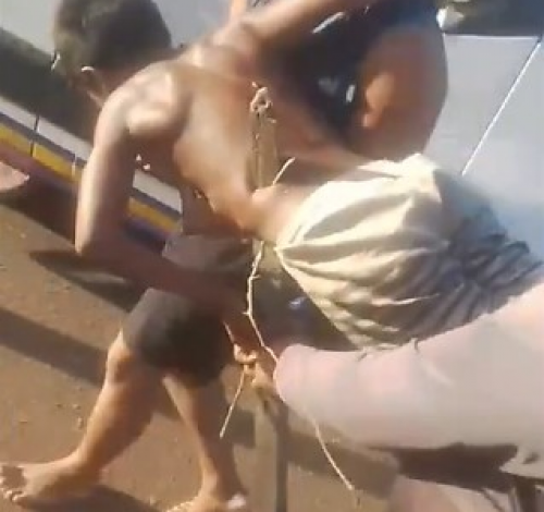 Menino sofre ferimentos graves após queda ao tentar recuperar pipa; veja vídeo