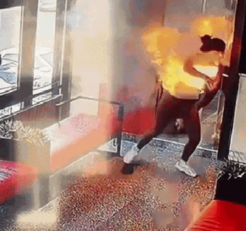 Carregador portátil explode dentro de bolsa e deixa influencer com sérias queimaduras